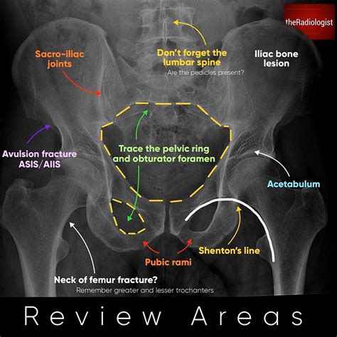 Pelvis X Ray Anatomy