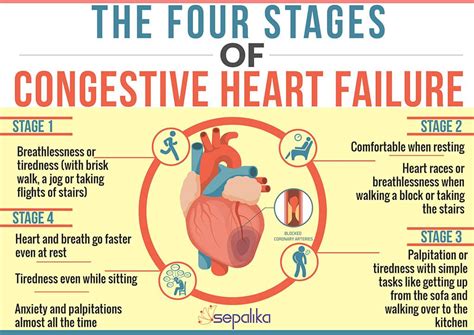 Stages of Heart Failure – St. Anthony's Hospice