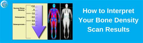 How to Interpret Your Bone Density Scan Results - True North Wellness