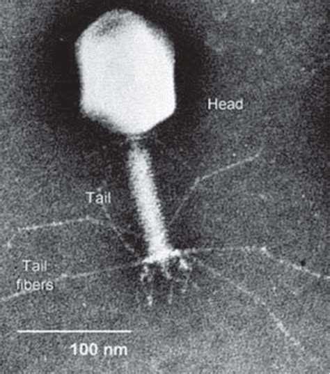 Electron micrograph of a bacteriophage | Download Scientific Diagram