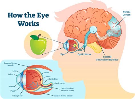 Cortical Visual Impairment Lawsuit - Pritzker Hageman, P.A.