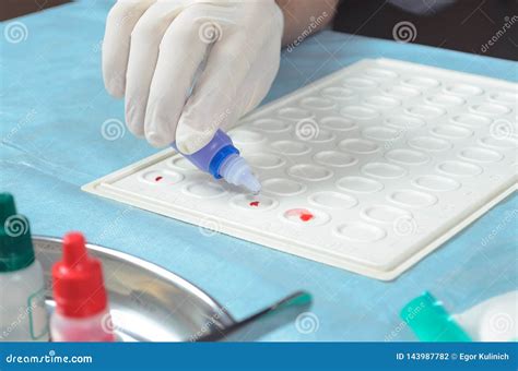 Blood Group and Rh Factor Testing Stock Photo - Image of laboratory ...