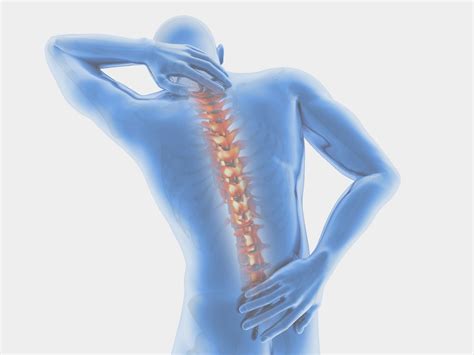 Arthritis symptoms of the spine and how to treat them - Perea Clinic