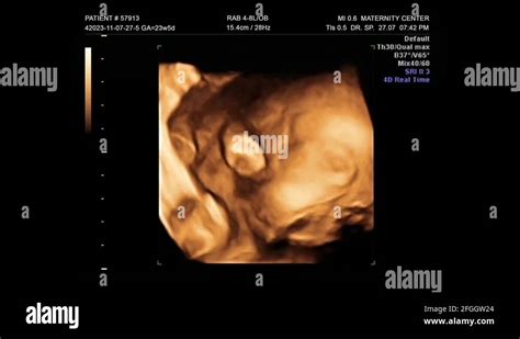 3d ultrasound baby Stock Videos & Footage - HD and 4K Video Clips - Alamy