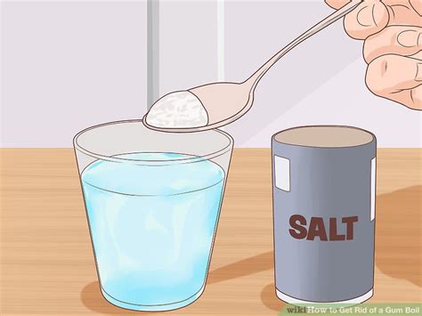 How to Get Rid of a Gum Boil: 10 Steps (with Pictures) - wikiHow