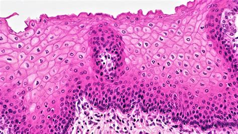 Difference Between Squamous Epithelium and Columnar Epithelium - Pediaa.Com