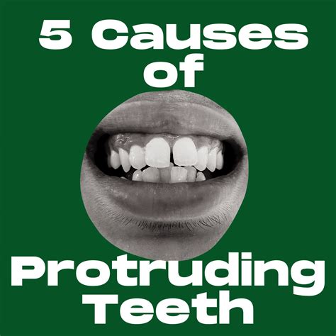 5 Causes Of Protruding Teeth | Acorn Dentistry For Kids