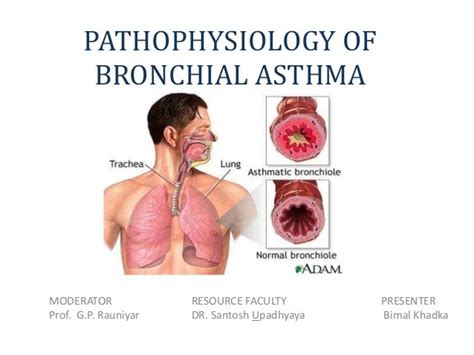 Pathophysiology of bronchial asthma f