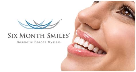 6 month smiles – Chrisp Street Dental Centre