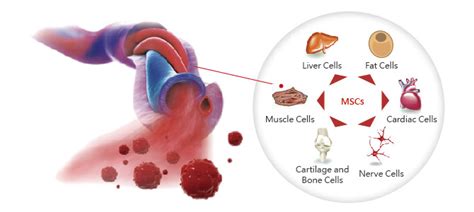 Umbilical Cord Stem Cells Treatment | Adult Stem Cell Therapy Abroad ...