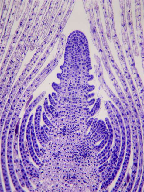 Apical meristem, terminal bud vector illustration (With images ...