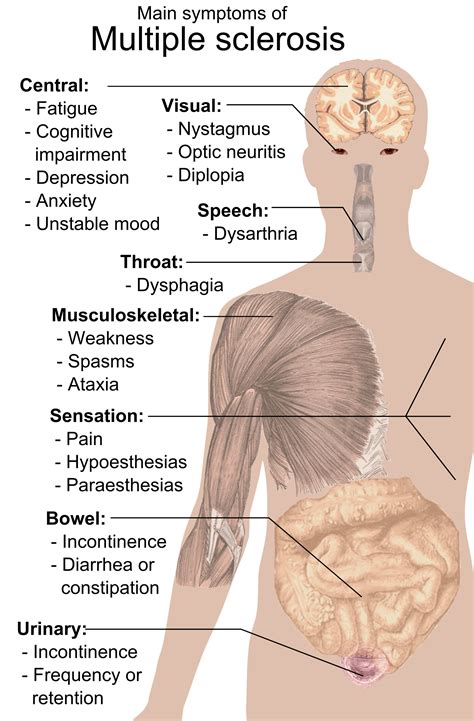 View 10 Multiple Sclerosis Skin Rash - Nova Benelux