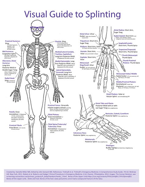 Visual Guide to Splinting — NUEM Blog