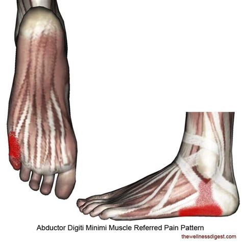 Abductor Digiti Minimi Muscle: Heel and Ankle Pain - The Wellness Digest