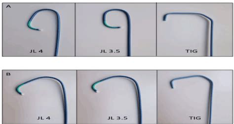 When right is left and left is right: using the JL3.5 guide catheter ...