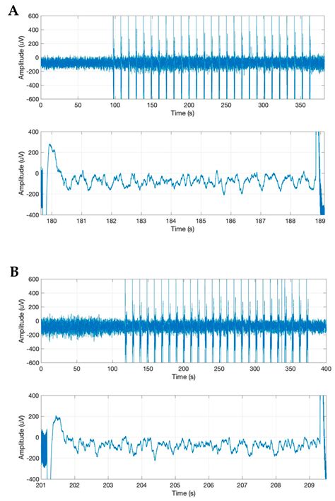 Brain Sciences | Free Full-Text | Electrical Stimulation in the ...