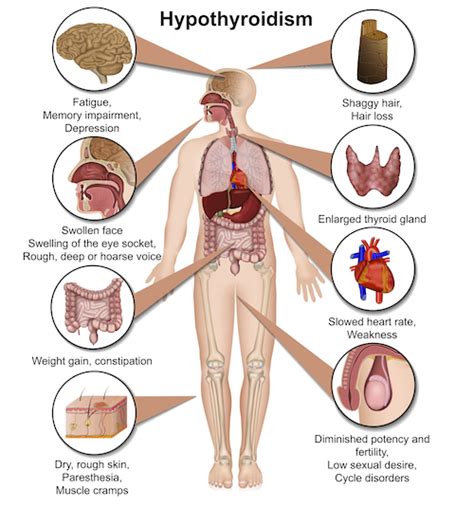 Signs of Thyroid Problems | TSC