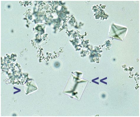 Direct Nucleation Of Calcium Oxalate Dihydrate Crystals, 46% OFF