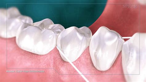 Proper Flossing Technique - Mint Hill Dentistry