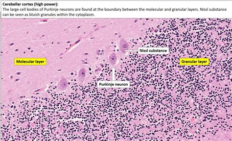 Brain – Cerebellum – NUS Pathweb :: NUS Pathweb