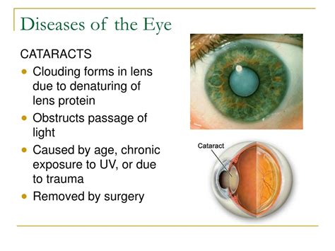 PPT - The Human Eye PowerPoint Presentation, free download - ID:9129134