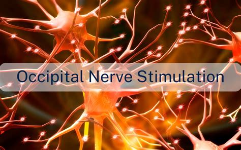 Occipital nerve stimulation - Giorgio Lambru - Neurologist