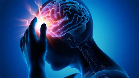 Subarachnoid Hemorrhage in the ED- What a Headache! - EMOttawa Blog