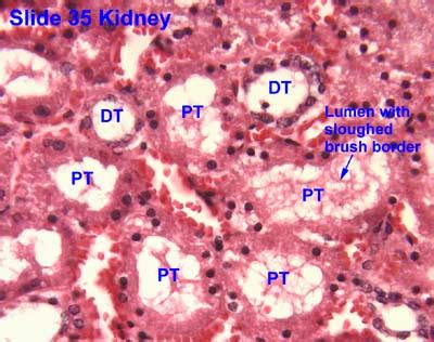 遠曲小管(Distal convoluted tubule, DCT) - 小小整理網站 Smallcollation