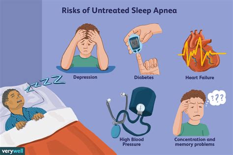 Sleep Apnea: Types, Causes, Symptoms, Treatment, and More