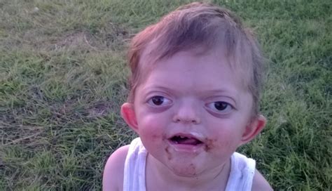 Mom Responds to Bullies Who Made Cruel Meme of Son With Rare Disorder ...