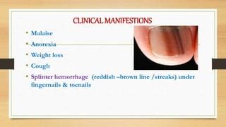 8.endocarditis | PPT