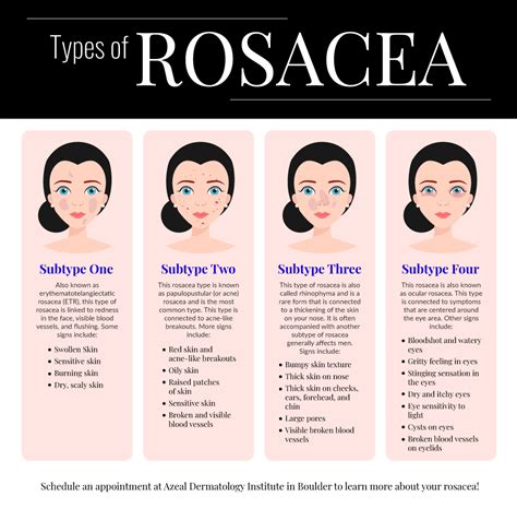 Rosacea Treatment - General Dermatology Services In Boulder | Azeal ...