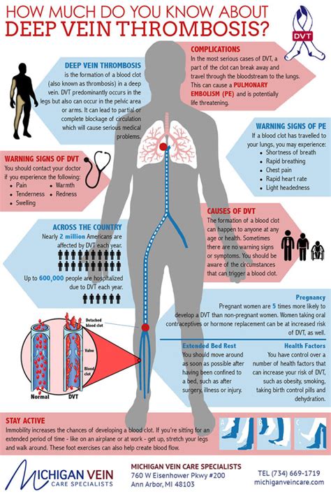 Deep Vein Thrombosis Infographic - Michigan Vein Care Specialists