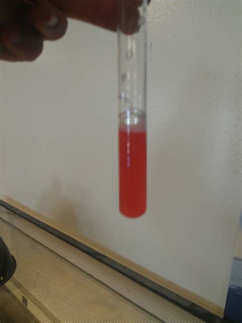 Bellarmine Biology Blog: Strawberry DNA Extraction Lab