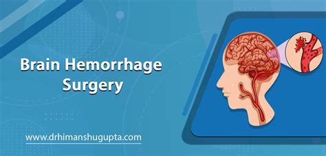 Brain Hemorrhage Surgery and Treatment in Jaipur - Dr. Himanshu Gupta