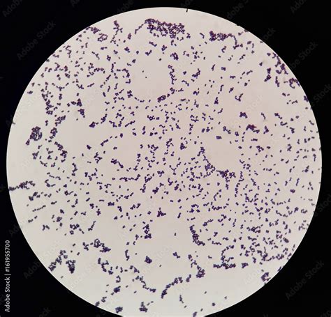 Cocci Bacteria Under Microscope