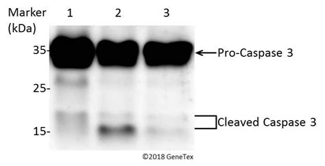 Anti-Caspase 3 antibody (GTX110543) | GeneTex