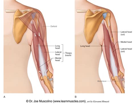 Triceps Muscle Strain: Cause, Symptoms, Treatment, Exercise Samarpan ...