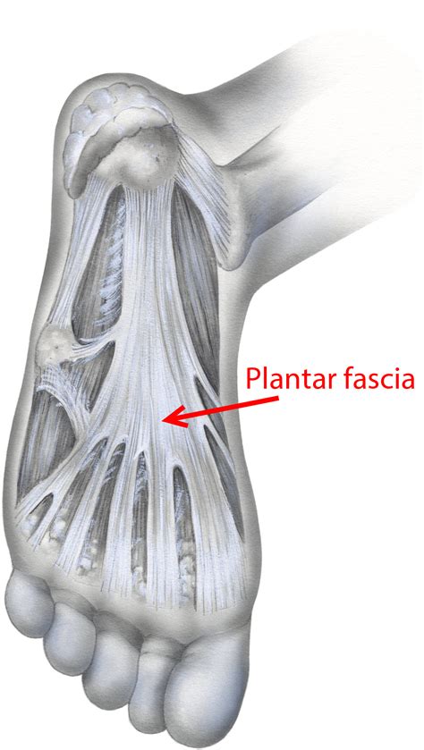 Easing the Heel Pain of Plantar Fasciitis | Highmark Health Blog