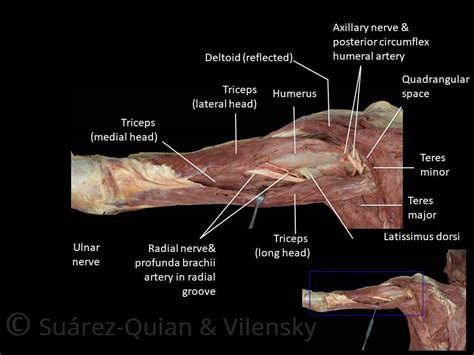 The Radial Nerve - Course - Motor - Sensory - TeachMeAnatomy | Human ...