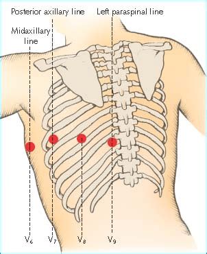 Lead Placement For Posterior ECG – Resus Review, 42% OFF