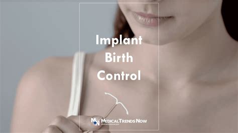 Implant Birth Control In The Philippines: Price, Removal, Pros and Cons ...