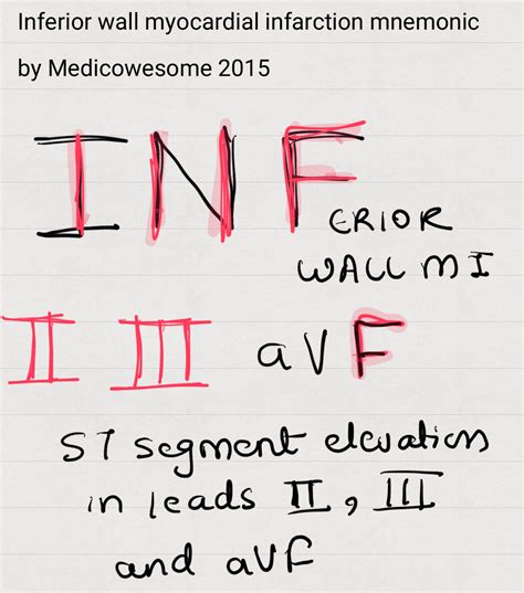 12 Lead Ecg Placement Mnemonic