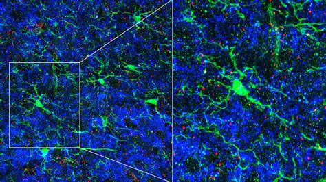 Immune cells sculpt circuits in the brain | Cold Spring Harbor Laboratory