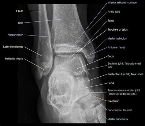 X Ray Anatomy - Anatomy Reading Source