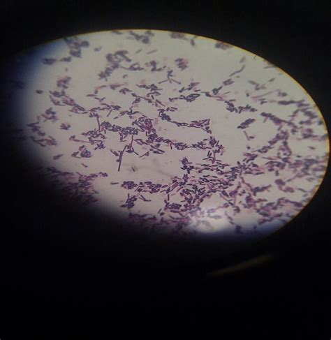 Clostridium tetani with terminal spores in certain morphology called ...