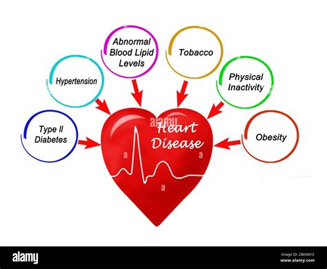 Six Causes of Heart Disease Stock Photo - Alamy