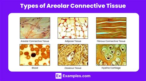 Areolar Tissue - Functions, Common Diseases and Conditions of Areolar ...