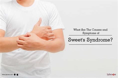 What Are The Causes and Symptoms of Sweet's Syndrome? - By Dr. Rasya ...