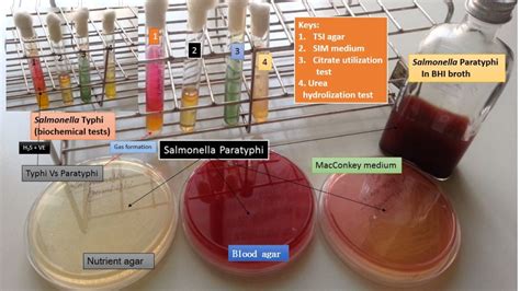 Salmonella: Introduction, Pathogenesis, Lab Diagnosis and treatment